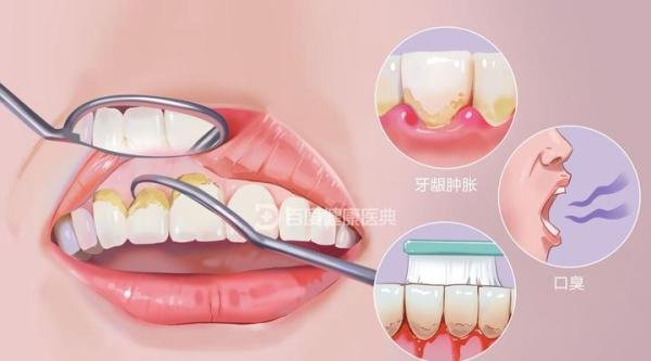 第一次洗牙是一种怎样的体验?(杭州版)