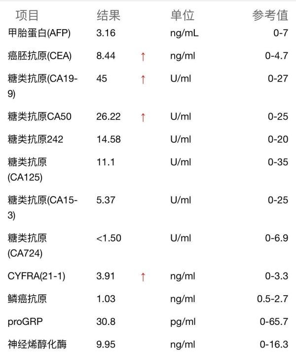 ADAU1452音频处理器芯片的概述及特性
