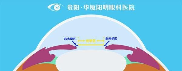 近视手术中的光区是什么？