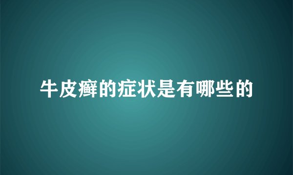 牛皮癣的症状是有哪些的