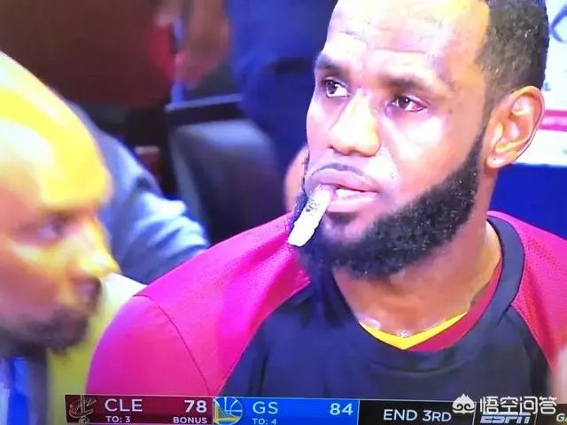 詹姆斯眼睛充血的问题怎么样了?