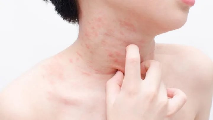 皮肤粗糙应该怎么办
