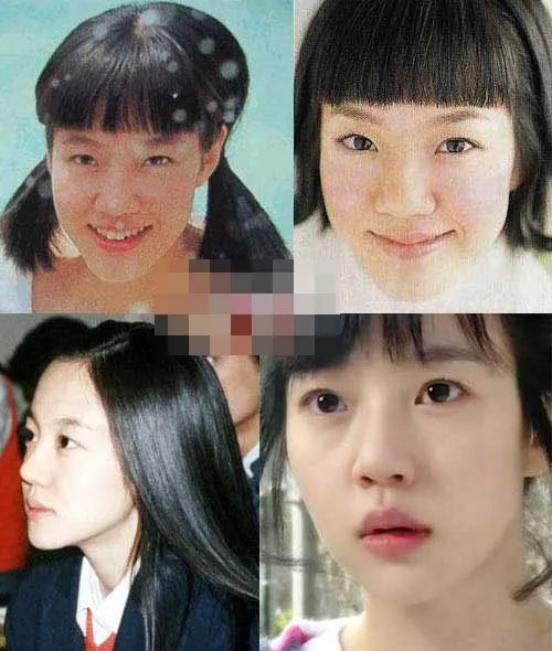 金喜善整容前的老照片曝光 金喜善的老公是谁有什么样的厉害背景