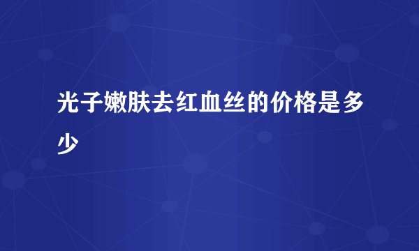 光子嫩肤去红血丝的价格是多少