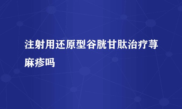 注射用还原型谷胱甘肽治疗荨麻疹吗