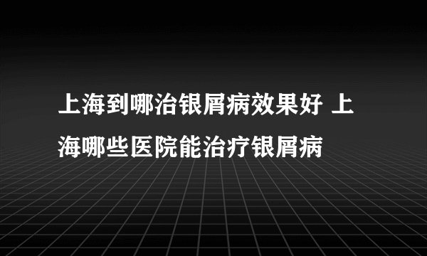 上海到哪治银屑病效果好 上海哪些医院能治疗银屑病