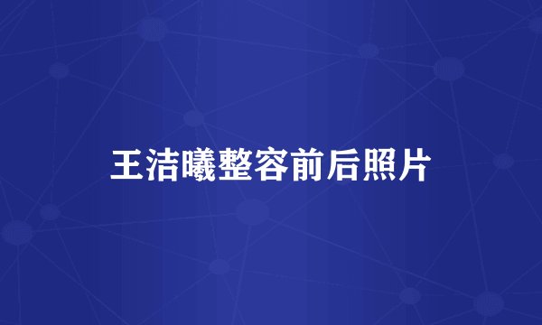 王洁曦整容前后照片
