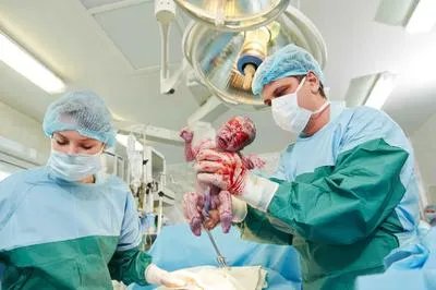 进行剖腹产后恶露多久干净算正常