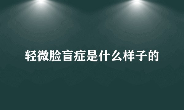 轻微脸盲症是什么样子的