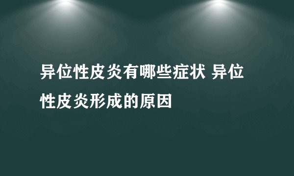 异位性皮炎有哪些症状 异位性皮炎形成的原因