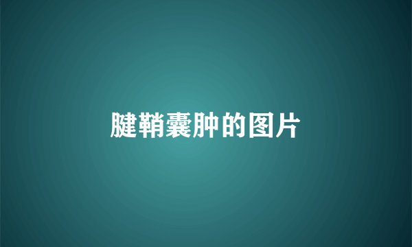 腱鞘囊肿的图片