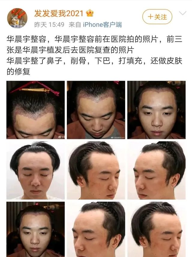 如何看待网友「发发爱我2021」爆料放锤华晨宇出轨、整容？事实的真相如何？