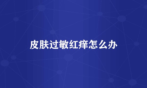 皮肤过敏红痒怎么办