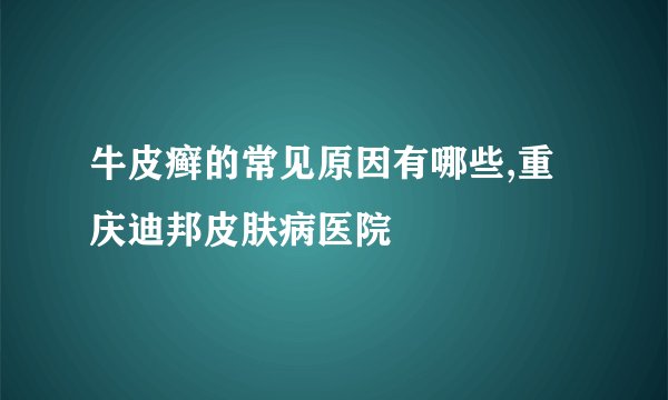 牛皮癣的常见原因有哪些,重庆迪邦皮肤病医院