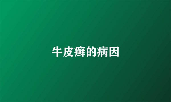 牛皮癣的病因