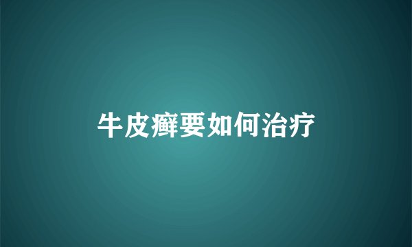 牛皮癣要如何治疗