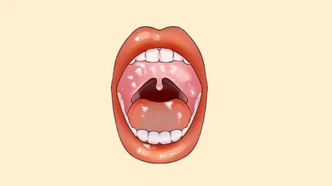 口角生疮怎么办