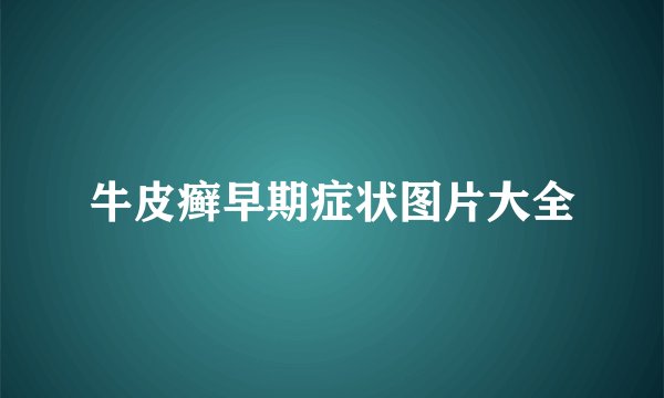 牛皮癣早期症状图片大全