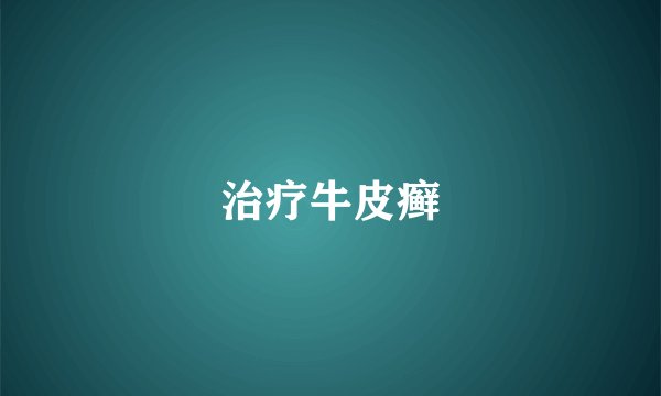 治疗牛皮癣