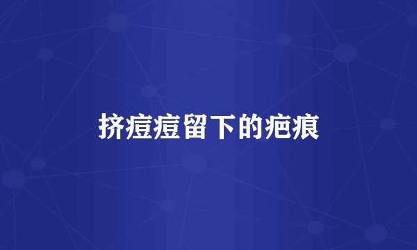 挤痘痘留下的疤痕
