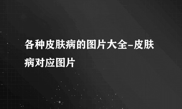 各种皮肤病的图片大全-皮肤病对应图片