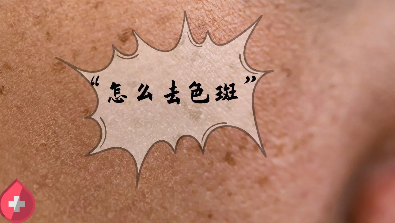 怎么去色斑