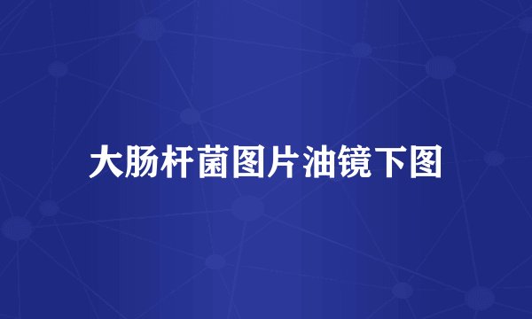 大肠杆菌图片油镜下图