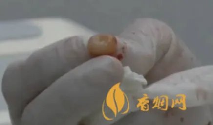 拔完牙多久可以献血 拔完牙注意事项