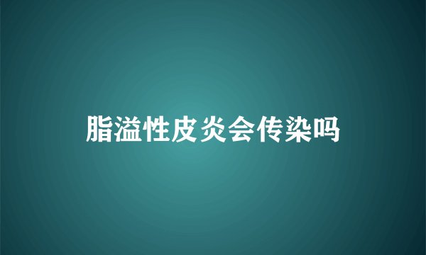 脂溢性皮炎会传染吗
