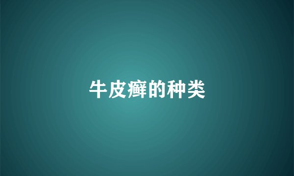 牛皮癣的种类