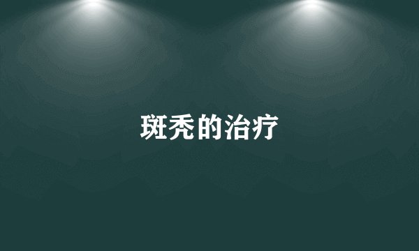 斑秃的治疗