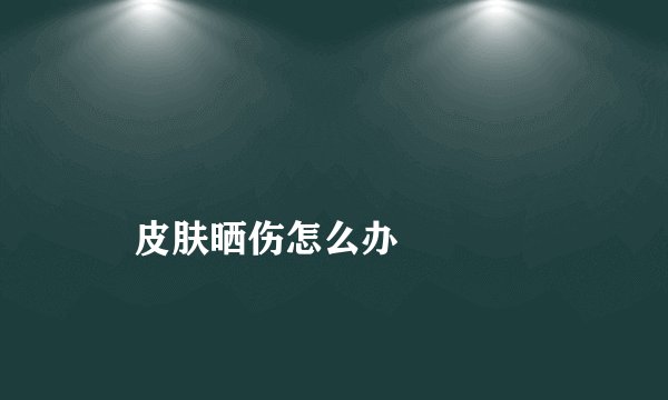 皮肤晒伤怎么办