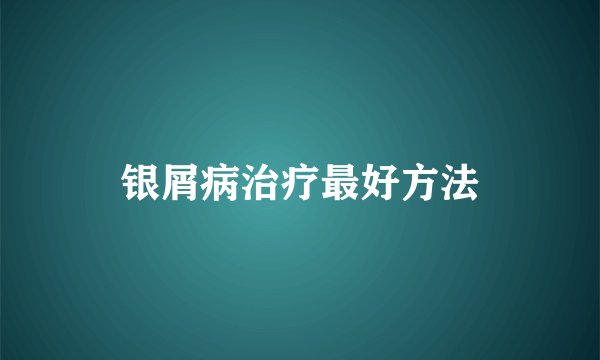 银屑病治疗最好方法