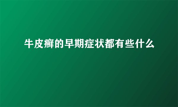 牛皮癣的早期症状都有些什么