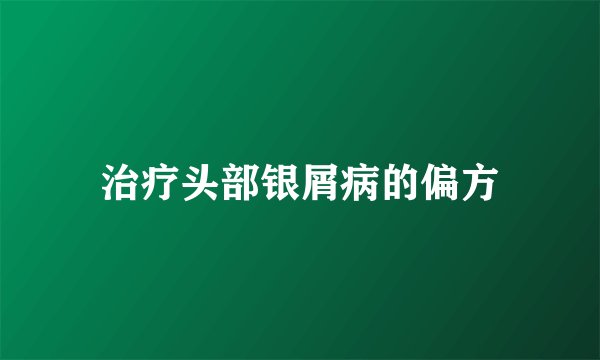 治疗头部银屑病的偏方
