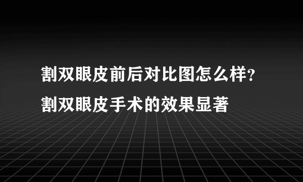 割双眼皮前后对比图怎么样？割双眼皮手术的效果显著