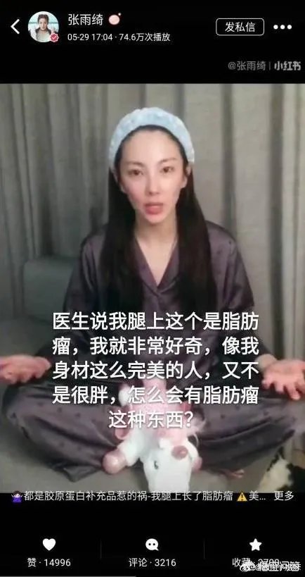为什么张雨绮在小红书上很受欢迎?