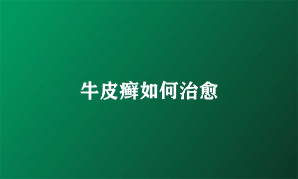 牛皮癣如何治愈