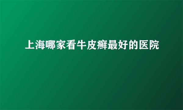 上海哪家看牛皮癣最好的医院