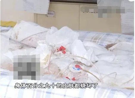 少女洗澡煤气爆炸