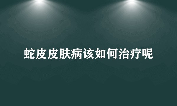 蛇皮皮肤病该如何治疗呢