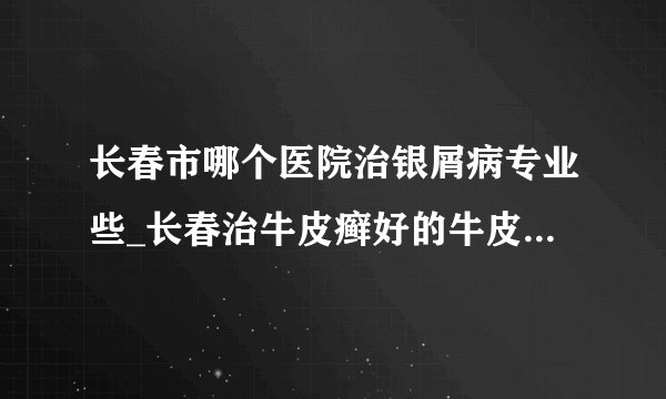 长春市哪个医院治银屑病专业些_长春治牛皮癣好的牛皮癣医院_长春哪里的牛皮癣医院正规专业