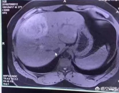 PDD现在为什么不直播了?