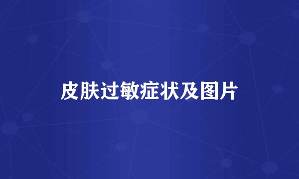 皮肤过敏症状及图片