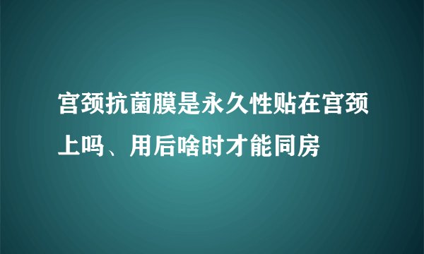 宫颈抗菌膜是永久性贴在宫颈上吗、用后啥时才能同房