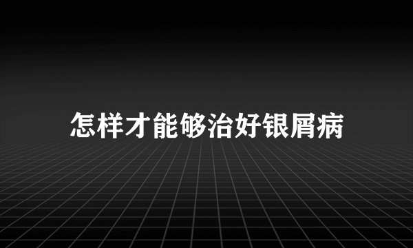 怎样才能够治好银屑病