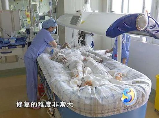 少女洗澡煤气爆炸