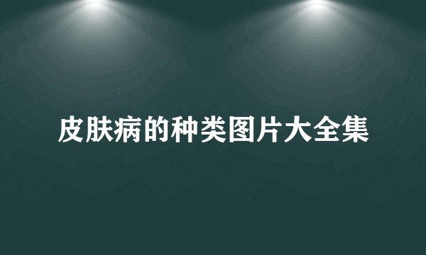 皮肤病的种类图片大全集