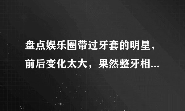 盘点娱乐圈带过牙套的明星,前后变化太大,果然整牙相当于整容
