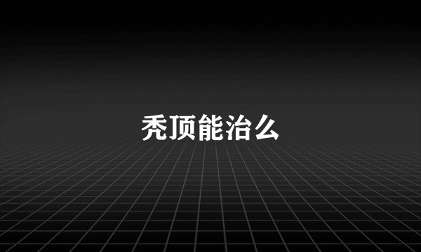 秃顶能治么